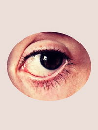 Zu sehen ist ein roten Auge